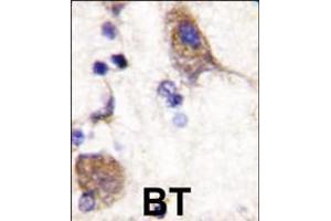 Formalin-fixed and paraffin-embedded human brain tissue reacted with SCYL2 , which was peroxidase-conjugated to the secondary antibody, followed by DAB staining. (SCYL2 antibody  (C-Term))