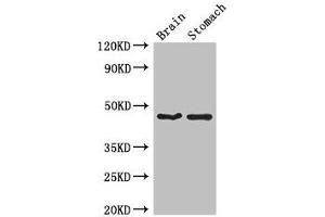 Western Blot Positive WB detected in: Mouse brain tissue, Mouse stomach tissue All lanes: TBC1D20 antibody at 4 μg/mL Secondary Goat polyclonal to rabbit IgG at 1/50000 dilution Predicted band size: 46, 20, 49 kDa Observed band size: 46 kDa (TBC1D2 antibody  (AA 1-237))