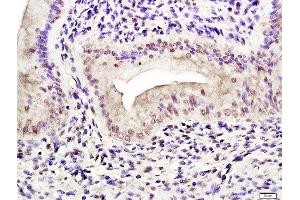 Paraformaldehyde-fixed, paraffin embedded rat uterus tissue, Antigen retrieval by boiling in sodium citrate buffer(pH6) for 15min, Block endogenous peroxidase by 3% hydrogen peroxide for 30 minutes, Blocking buffer (normal goat serum) at 37°C for 20min, Antibody incubation with Rabbit Anti-Estrogen receptor alpha (Ser118) Polyclonal Antibody, Unconjugated  at 1:400 overnight at 4°C, followed by a conjugated secondary and DAB staining (Estrogen Receptor alpha antibody  (pSer118))