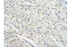 Rabbit Anti-FOXJ3 antibody        Paraffin Embedded Tissue:  Human Heart cell   Cellular Data:  Epithelial cells of renal tubule  Antibody Concentration:   4. (FOXJ3 antibody  (Middle Region))