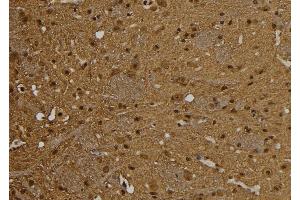 ABIN6277542 at 1/100 staining Rat brain tissue by IHC-P. (PSME1 antibody  (C-Term))