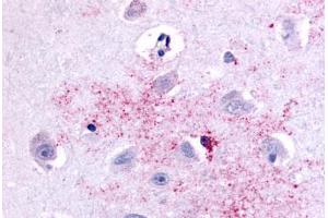 Anti-PAK6 antibody  ABIN1049228 IHC staining of human brain, neurons and glia. (PAK6 antibody  (Linker Domain))