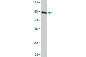 Western Blot detection against Immunogen (76. (STK38 antibody  (AA 1-465))