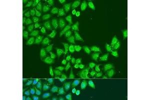 Immunofluorescence analysis of U2OS cells using STAT5A Polyclonal Antibody at dilution of 1:100. (STAT5A antibody)