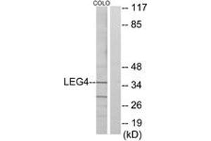 Western blot analysis of extracts from COLO cells, using LEG4 Antibody. (GAL4 antibody  (AA 61-110))