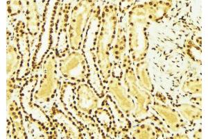 ABIN6269364 at 1/100 staining Mouse kidney tissue by IHC-P. (ERBB4 antibody  (C-Term))