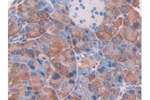 DAB staining on IHC-P; Samples: Mouse Pancreas Tissue (Thrombospondin 2 antibody  (AA 968-1170))