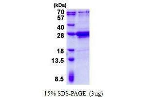 Figure annotation denotes ug of protein loaded and % gel used. (AMELX Protein)