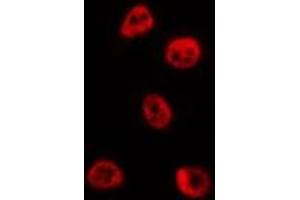 ABIN6273993 staining HepG2 by IF/ICC. (BCL6 antibody  (Internal Region))