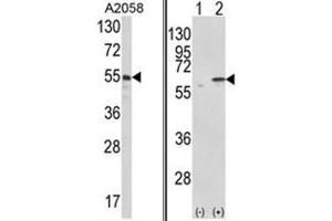 (LEFT) Western blot analysis of PDIA3 Antibody (C-term) in A2058 cell line lysates (35ug/lane). (PDIA3 antibody  (C-Term))