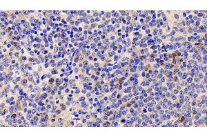 Detection of IL22R in Human Spleen Tissue using Polyclonal Antibody to Interleukin 22 Receptor (IL22R) (IL22R antibody  (AA 267-565))