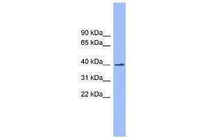 WB Suggested Anti-EXOD1 Antibody Titration: 0. (ERI2 antibody  (N-Term))
