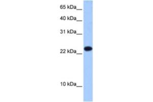 Western Blotting (WB) image for anti-Eukaryotic Translation Initiation Factor 4E Family Member 3 (EIF4E3) antibody (ABIN2462352) (EIF4E3 antibody)