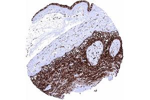Placenta amnion and chorion Membranous GLUT1 staining is very intense in amnion and chorion cells. (Recombinant GLUT1 antibody  (AA 203-305))