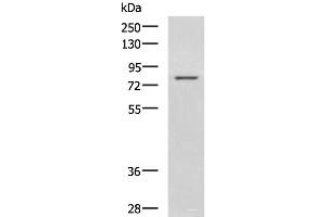 Western blot analysis of Rat liver tissue lysate using DHX58 Polyclonal Antibody at dilution of 1:800