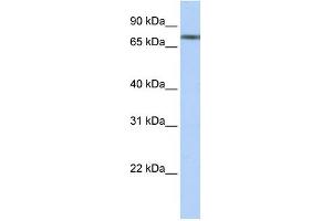 WB Suggested Anti-TRIM29 Antibody Titration:  0. (TRIM29 antibody  (N-Term))