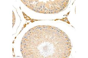Immunohistochemistry of paraffin embedded rat testis using erf1 (ABIN7073895) at dilution of 1: 2400 (400x lens) (ETF1 antibody)