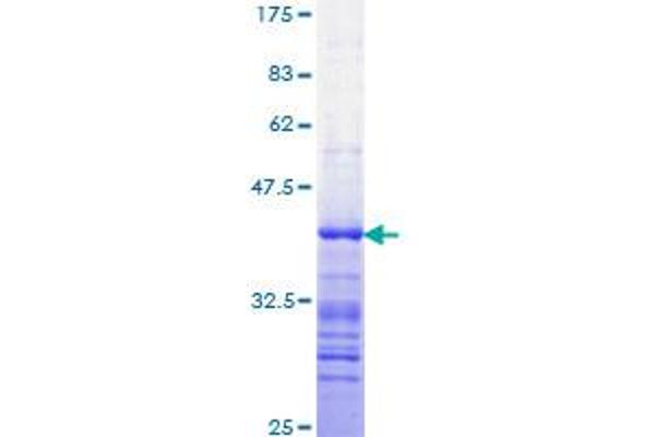 STAT3 Protein (AA 670-769) (GST tag)