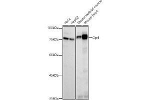 Western blot analysis of extracts of various cell lines, using Cip4 antibody (ABIN7270822) at 1:500 dilution. (TRIP10 antibody)