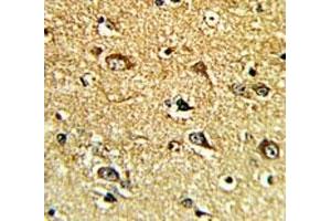 IHC analysis of FFPE human brain tissue with TH antibody