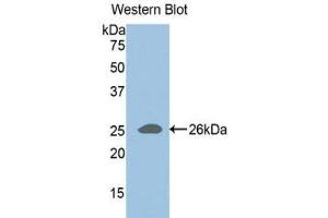Western Blotting (WB) image for anti-ADAM Metallopeptidase with Thrombospondin Type 1 Motif, 1 (ADAMTS1) (AA 258-467) antibody (ABIN1857895) (ADAMTS1 antibody  (AA 258-467))