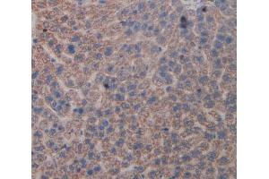 Used in DAB staining on fromalin fixed paraffin- embedded liver tissue (CD39 antibody  (AA 213-452))