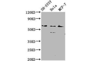 Western Blot Positive WB detected in: SH-SY5Y whole cell lysate, Hela whole cell lysate, MCF-7 whole cell lysate All lanes: RANBP10 antibody at 2. (RANBP1 antibody  (AA 3-165))