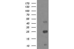 Western Blotting (WB) image for anti-Aldehyde Dehydrogenase 1 Family, Member A3 (ALDH1A3) (AA 1-100), (AA 413-512) antibody (ABIN2715886) (ALDH1A3 antibody  (AA 1-100, AA 413-512))