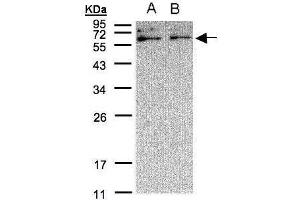 WB Image Sample(30 μg of whole cell lysate) A:A431, B:H1299 12% SDS PAGE antibody diluted at 1:500 (XYLB antibody  (C-Term))