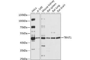 Western blot analysis of extracts of various cell lines, using TRNT1 antibody (ABIN7271005) at 1:1000 dilution. (Trnt1 antibody  (AA 135-434))