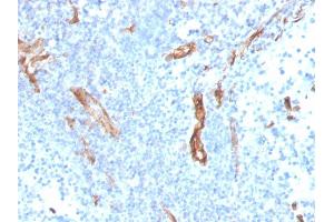 Immunohistochemistry (IHC) image for anti-Platelet/endothelial Cell Adhesion Molecule (PECAM1) (AA 625-738) antibody (ABIN6940277)