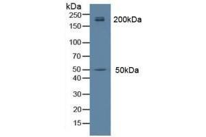 Detection of MYH14 in Rat Brain Tissue using Polyclonal Antibody to Myosin Heavy Chain 14, Non Muscle (MYH14) (Myosin antibody  (AA 1069-1331))