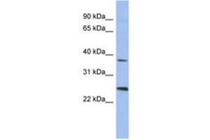 Image no. 1 for anti-Melanoma Antigen Family B, 2 (MAGEB2) (AA 71-120) antibody (ABIN6744051)