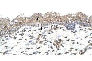 RNF25 antibody was used for immunohistochemistry at a concentration of 4-8 ug/ml to stain Squamous epithelial cells (arrows) in Human Skin. (RNF25 antibody  (Middle Region))