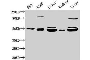 Western Blot Positive WB detected in: 293 whole cell lysate, HL60 whole cell lysate, Rat liver tissue, Mouse kidney tissue, Mouse liver tissue All lanes: NADK2 antibody at 4 μg/mL Secondary Goat polyclonal to rabbit IgG at 1/50000 dilution Predicted band size: 50, 46, 32 kDa Observed band size: 50, 46 kDa (NADK2 antibody  (AA 16-156))