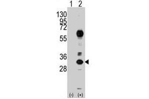 Western blot analysis of CD8A (arrow) using rabbit CD8A polyclonal antibody . (CD8 alpha antibody  (N-Term))