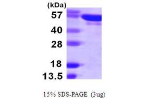 SDS-PAGE (SDS) image for Tyrosyl-tRNA Synthetase (Yars) (AA 1-528) protein (His tag) (ABIN7279434)