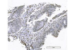 IHC analysis of FOXK1 using anti-FOXK1 antibody (ABIN7600295). (Foxk1 antibody  (AA 175-671))