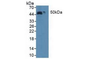 Western blot analysis of (1) Human HepG2 cells and (2) Human HCT116 cell. (MAT2A antibody  (AA 176-395))