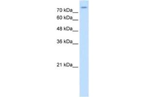 Western Blotting (WB) image for anti-Solute Carrier Family 20 (Phosphate Transporter), Member 2 (SLC20A2) antibody (ABIN2462564) (SLC20A2 antibody)