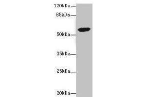 Western blot All lanes: ETFDH antibody at 3. (ETFDH antibody  (AA 318-617))