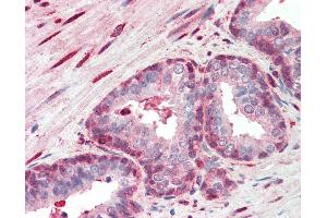 Anti-SRSF2 / SC35 antibody IHC staining of human prostate. (SRSF2 antibody  (C-Term))