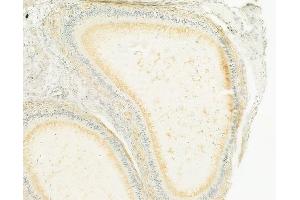 ABIN6265146 and ABIN6279837 at 1/100 staining human testicular cancer by IHC-P.