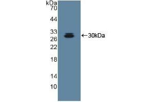 Detection of Recombinant ADAM10, Human using Polyclonal Antibody to A Disintegrin And Metalloprotease 10 (ADAM10) (ADAM10 antibody  (AA 420-641))