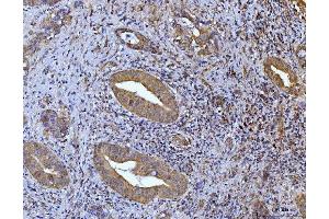 IHC analysis of Glutaminase/GLS using anti-Glutaminase/GLS antibody (ABIN7601602). (Glutaminase antibody  (AA 396-654))