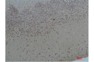 Immunohistochemistry (IHC) analysis of paraffin-embedded Rat Brain Tissue using Bombesin Receptor 2 Rabbit Polyclonal Antibody diluted at 1:200. (Bombesin Receptor 2 antibody)