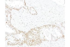 anti-Bloom Syndrome RecQ Like Helicase (BLM) (C-Term) antibody