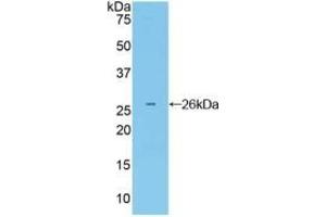Detection of Recombinant Grb7, Mouse using Polyclonal Antibody to Growth Factor Receptor Bound Protein 7 (Grb7) (GRB7 antibody  (AA 298-489))
