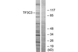 Western blot analysis of extracts from 293 cells, using TF3C3 Antibody. (GTF3C3 antibody  (AA 101-150))