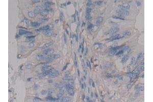 Immunohistochemistry (IHC) image for anti-Syndecan 1 (SDC1) (AA 23-253) antibody (ABIN7434419)